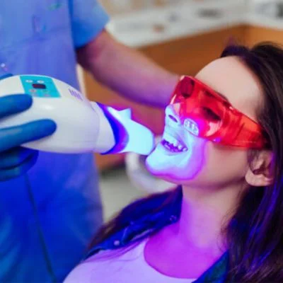 Teeth Whitening