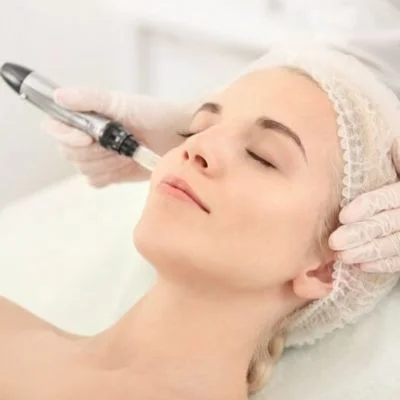 Skin Lightening Treatments